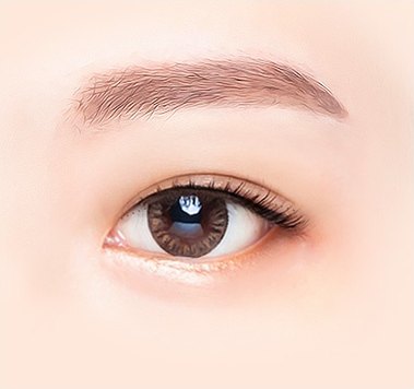 비절개 쌍꺼풀 6단계 — 수술 후, 또렷한 쌍꺼풀 라인이 생긴 채 크게 뜬 눈 클로즈업 도해 일러스트