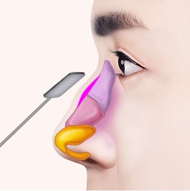 라스프로 튀어나온 콧등 뼈를 다듬는 옆얼굴 단면 일러스트