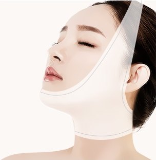 수술 후 얼굴 압박밴드를 착용한 도해