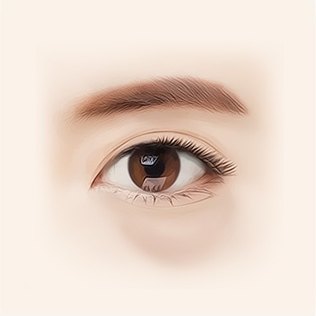 30대 눈 일러스트 — 안와지방이 더 돌출되고 눈물고랑이 생기기 시작한다