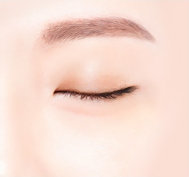 수술 후 — 눈 밑 지방과 눈물고랑이 정리되어 매끈해진 눈 일러스트