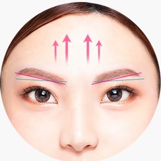눈썹 위로 분홍 화살표가 올라가는 눈매 교정 도해