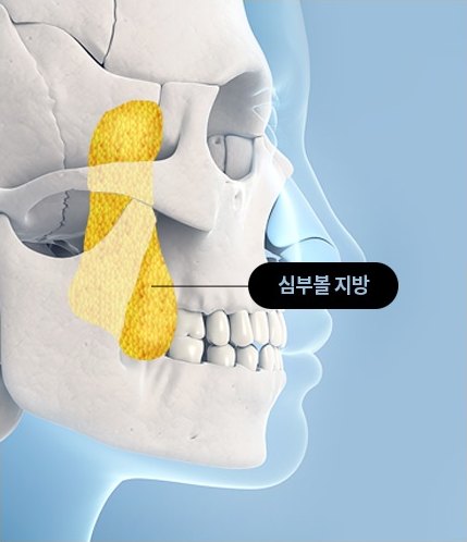 두개골 측면 3D 일러스트에서 광대 아래 심부볼 지방이 노란색으로 강조되어 있고 ‘심부볼 지방’ 라벨이 그 부위를 가리킨다