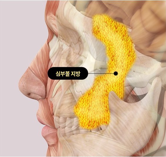 얼굴 근육 해부 일러스트에서 볼 안쪽 심부볼 지방이 노란 덩어리로 강조되어 있고 ‘심부볼 지방’ 라벨이 그 부위를 가리킨다