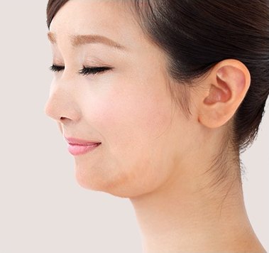 시술 전 — 턱선과 목 라인이 보이는 여성의 측면 얼굴