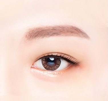수술 후 — 처짐이 개선되어 또렷하게 뜬 눈과 정돈된 눈썹을 그린 의학 일러스트