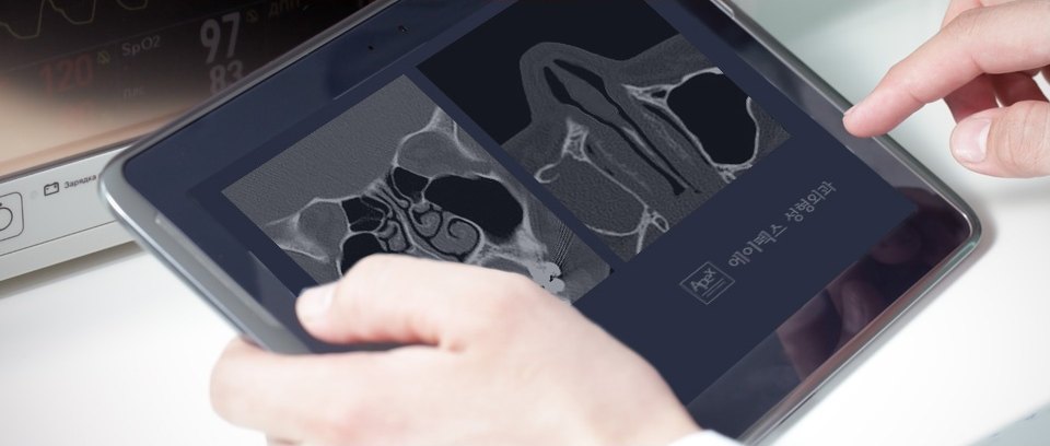 태블릿에 띄운 코 CT·X-ray 판독 화면을 손가락으로 가리키는 모습