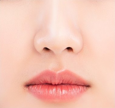 수술 후 — 팔자 부위에 볼륨이 채워져 코 옆에서 입가로 완만하게 이어지는 얼굴 중앙.