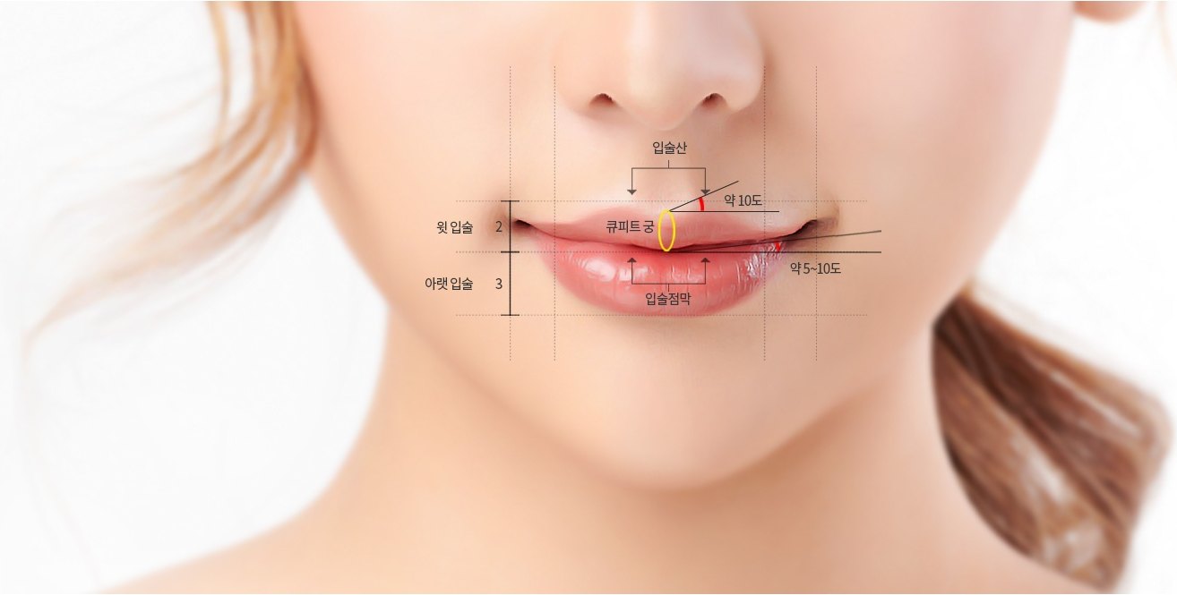 여성 하안면 클로즈업 도해 — 입술산, 큐피트 궁, 입술점막 위치와 윗 입술 2 : 아랫 입술 3 의 비율, 약 10도와 약 5~10도의 각도가 표시되어 있다