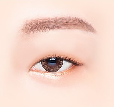 쌍꺼풀 없이 눈을 뜬 수술 전 상태의 오른쪽 눈 클로즈업 일러스트