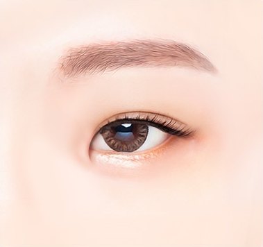 몽고주름이 덮여 답답해 보이는 수술 전 눈매 일러스트