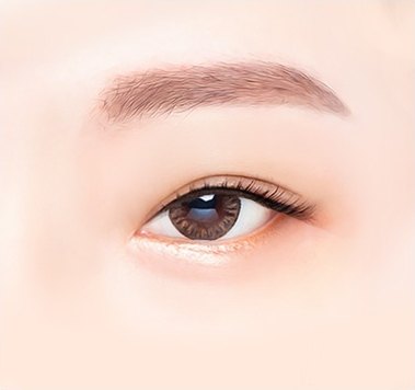 쌍꺼풀은 있으나 답답해 보이는 수술 전 눈매 일러스트