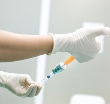 흰색 라텍스 장갑을 낀 양손이 주황색 커넥터가 달린 주사기에서 정제 지방을 이식용 주사기로 옮기고 있다