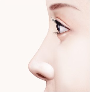 수술 전 — 길이가 짧고 낮은 코의 옆모습 일러스트